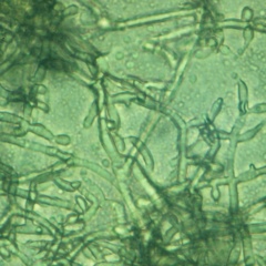 Trichodarma viride - Vi sinh đơn dòng
