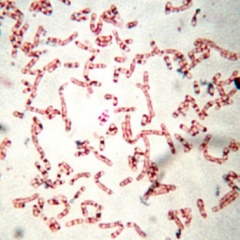 Rhodococcus spp - Vi sinh đơn dòng